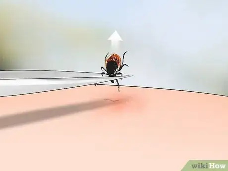 Imagen titulada Identify Tick Bites Step 4