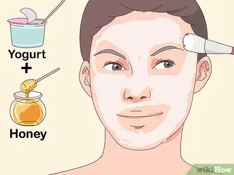 Imagen titulada Treat Nodular Acne Step 10