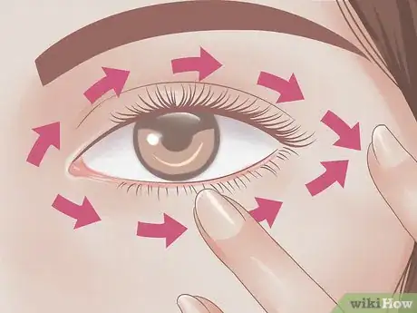 Imagen titulada Reduce Puffy Eyes Step 17