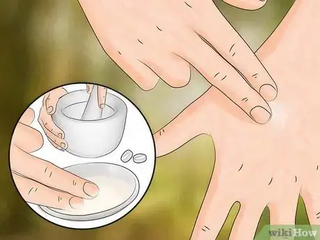 Imagen titulada Get Rid of Bug Bites Step 10