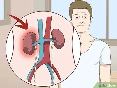 Imagen titulada Know if You Have Kidney Problems Step 11