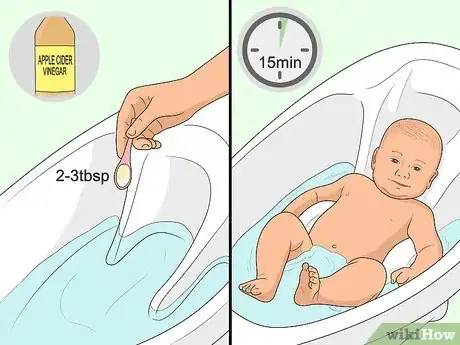 Imagen titulada Relieve Diaper Rash Fast Step 12