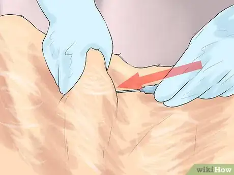 Imagen titulada Give Subcutaneous Fluids to a Cat Step 11