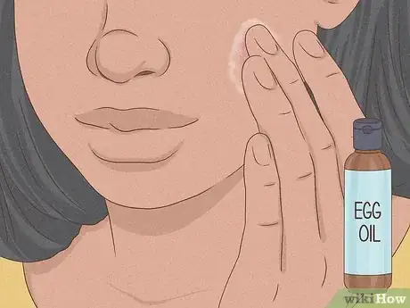 Imagen titulada Get Rid of a Zit Overnight Step 7