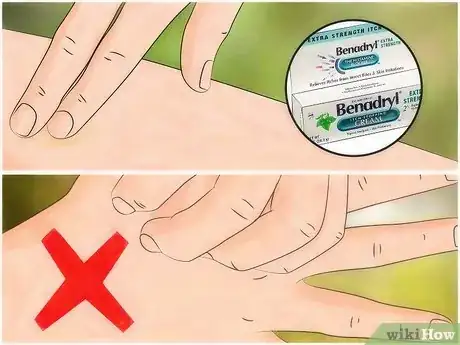 Imagen titulada Identify Insect Bites Step 10