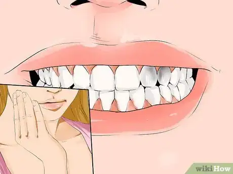 Imagen titulada Heal Dental Cavities Naturally Step 7