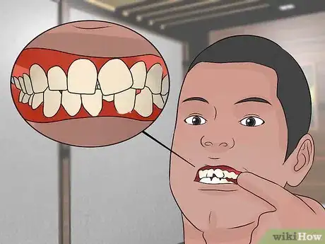 Imagen titulada Determine if a Tooth Needs to Be Pulled Step 5