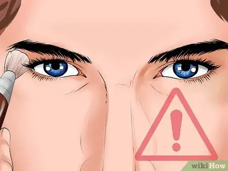 Imagen titulada Heal a Scratched Cornea Step 9