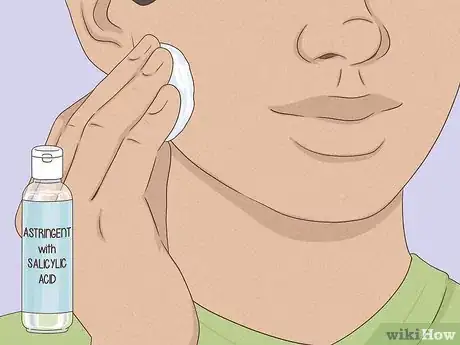 Imagen titulada Get Rid of a Zit Overnight Step 6