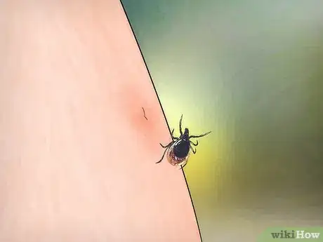 Imagen titulada Remove a Deer Tick Step 16