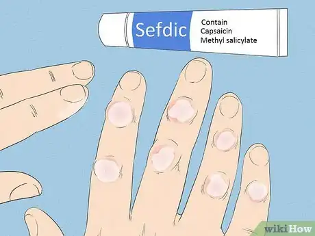 Imagen titulada Get Rid of Arthritis Bumps on Fingers Step 4