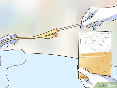 Imagen titulada Insert a Catheter Step 11