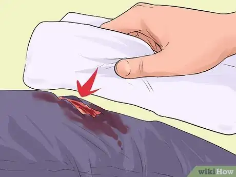 Imagen titulada Treat Severe Bleeding During First Aid Step 10