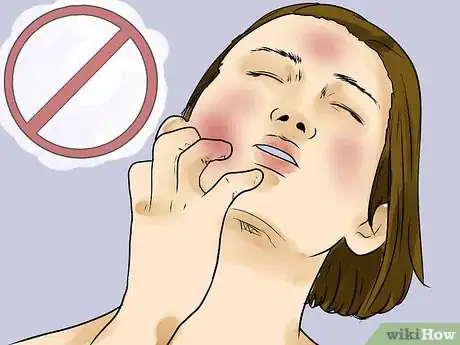 Imagen titulada Prevent Skin Peeling After Sunburn Step 12