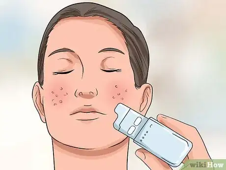 Imagen titulada Get Rid of Large Pores and Blemishes Step 16