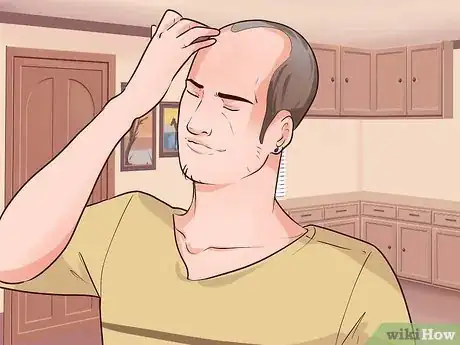 Imagen titulada Adjust to Hair Loss and Baldness Step 3