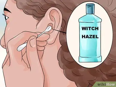 Imagen titulada Get Rid of Pimples Inside the Ear Step 3