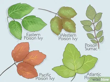 Imagen titulada Dry Up Poison Ivy Rash Step 11