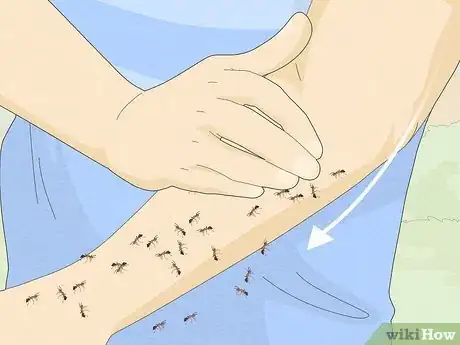 Imagen titulada Treat a Fire Ant Sting Step 11