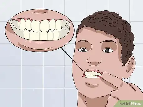 Imagen titulada Recognize Tooth Enamel Loss Step 1