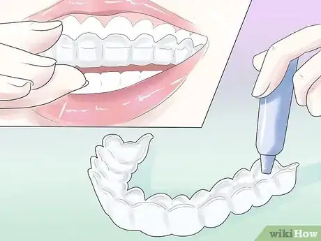 Imagen titulada Cope with Teeth Whitening Sensitivity Step 3