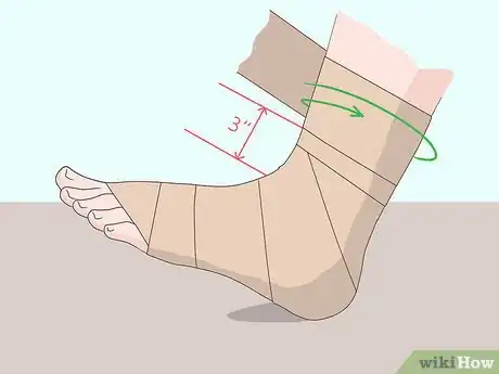 Imagen titulada Wrap an Ankle with an ACE Bandage Step 6