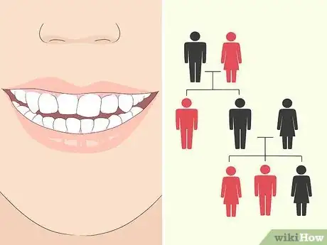 Imagen titulada Fix an Uneven Smile Step 1