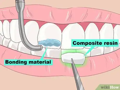 Imagen titulada Remove Brown Stains from Teeth Step 8