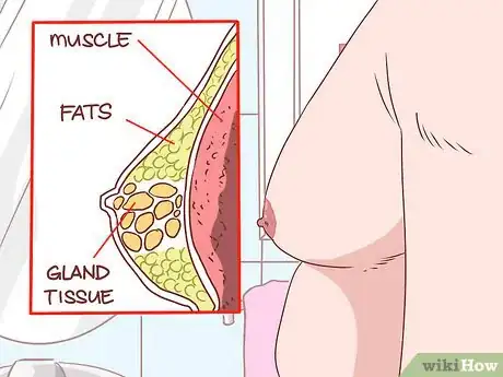 Imagen titulada Recognize Cirrhosis Step 13