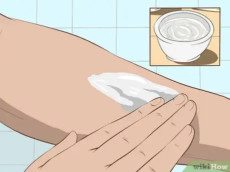 Imagen titulada Stop Mosquito Bites from Itching Step 6