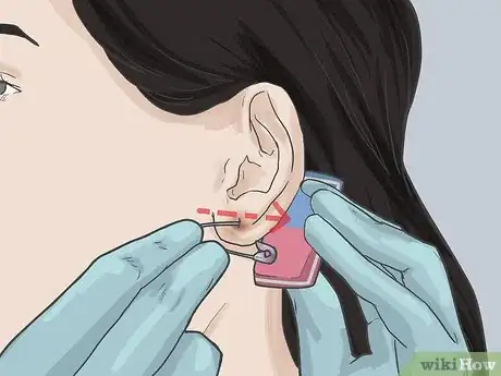 Imagen titulada Pierce Your Ear with a Safety Pin Step 8