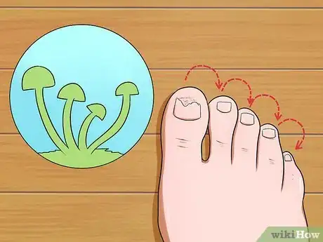 Imagen titulada Prevent Nail Fungus Step 4