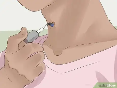 Imagen titulada Get Rid of Skin Tags Step 18