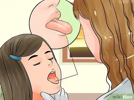 Imagen titulada Fix a Toddler's Chapped Lips Step 11