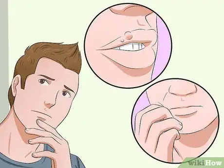 Imagen titulada Heal Cold Sores Step 1