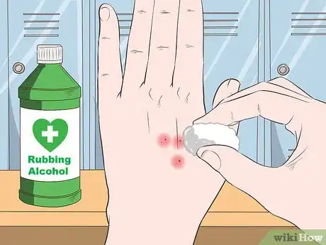 Imagen titulada Stop Mosquito Bites from Itching Step 9