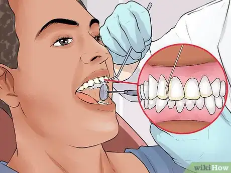 Imagen titulada File Down Dentures Step 8