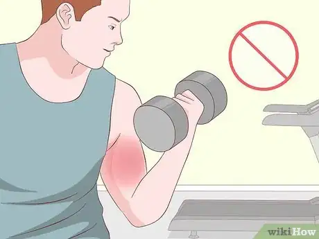 Imagen titulada Treat Bicep Tendonitis Step 1