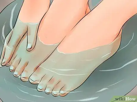 Imagen titulada Remove an Ingrown Toenail Step 1