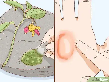 Imagen titulada Get Rid of Poison Ivy Rashes Step 6