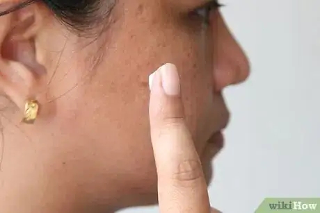 Imagen titulada Apply Toothpaste on Pimples Step 8