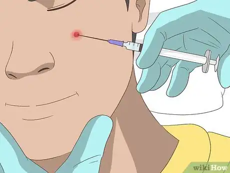 Imagen titulada Shrink Pimples Step 12