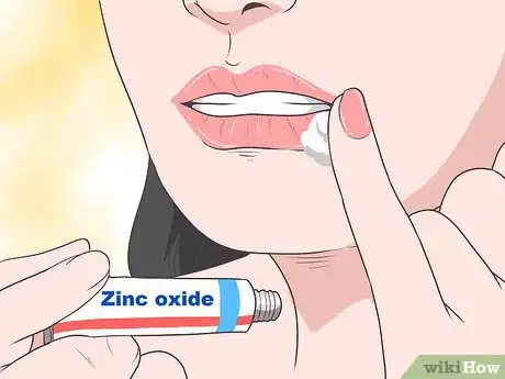 Imagen titulada Treat a Cold Sore or Fever Blisters Step 7