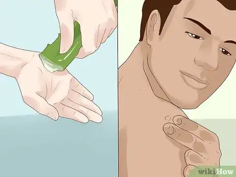 Imagen titulada Get Rid of Skin Tags Step 10