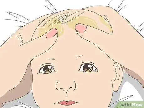 Imagen titulada Get Rid of Cradle Cap Step 3