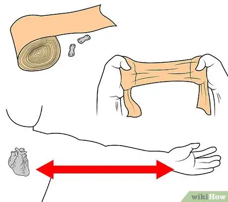 Imagen titulada Wrap a Wrist Step 1