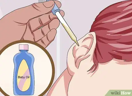 Imagen titulada Clean Ears with Peroxide Step 6