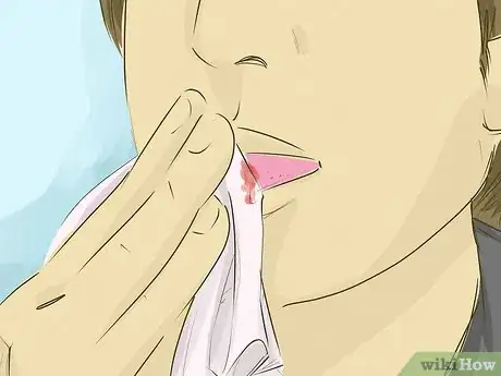 Imagen titulada Heal a Cut on Your Tongue Step 4