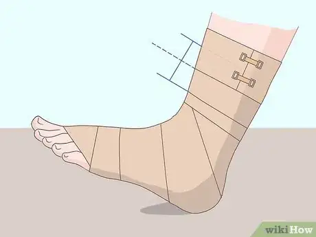 Imagen titulada Wrap an Ankle with an ACE Bandage Step 7