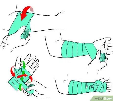 Imagen titulada Wrap a Wrist Step 7